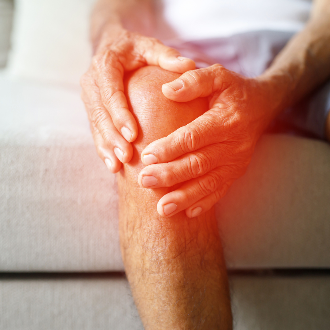 Knee Arthritis Doesn’t Mean Surgery – How Physiotherapy Delay a Knee Replacement